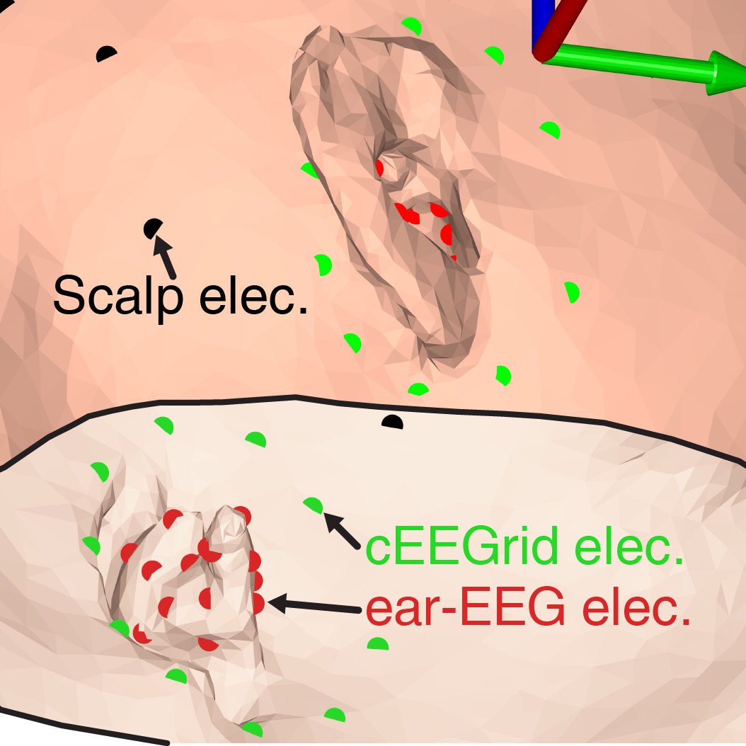 SimonLKappel's tweet photo. Our recent paper on ear-EEG forward models, is the first to present simultaneous recordings of high-density scalp EEG, dry-contact electrode cEEGrid, and high-density dry-contact electrode ear-EEG.
https://t.co/tqHpwldqSU

Dry-contact electrode paper: https://t.co/sI99R8aTC2 https://t.co/Qs2lPRAxZC