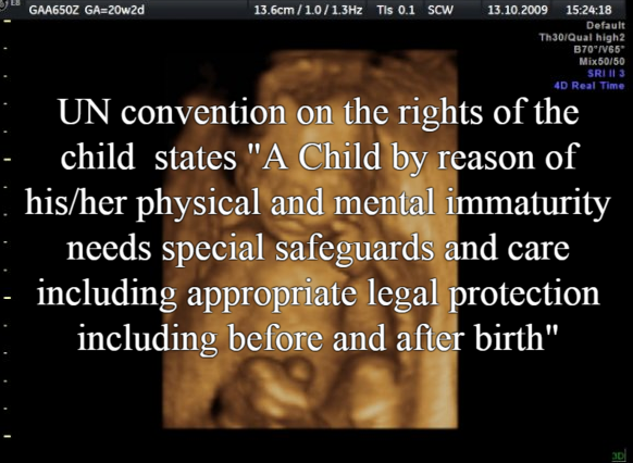 bjee77's tweet photo. @AgeSMH_Archives @smh How many innocent NSW children has lost their lives since then #abortion #NSWpol? #abortionsurvivorbabies #mychoicemybody #letsgetthisodne #itsnot1899 #abortionrethink #nswnationals #nswliberals #nswgreens #fostercare #NSWLC #childabuse #auspol #UN https://t.co/VhuaMTTWDA