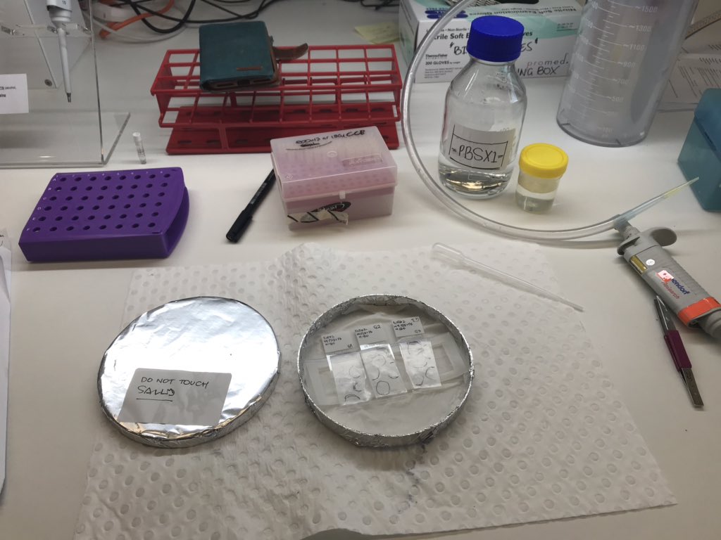 Esallee's tweet photo. Fingers crossed ๐ค my first staining works! Even with new #microglia anti-bodies #TMEM119 #P2YR12 #brainorganoids #braintissue https://t.co/q1HYh2TGtt