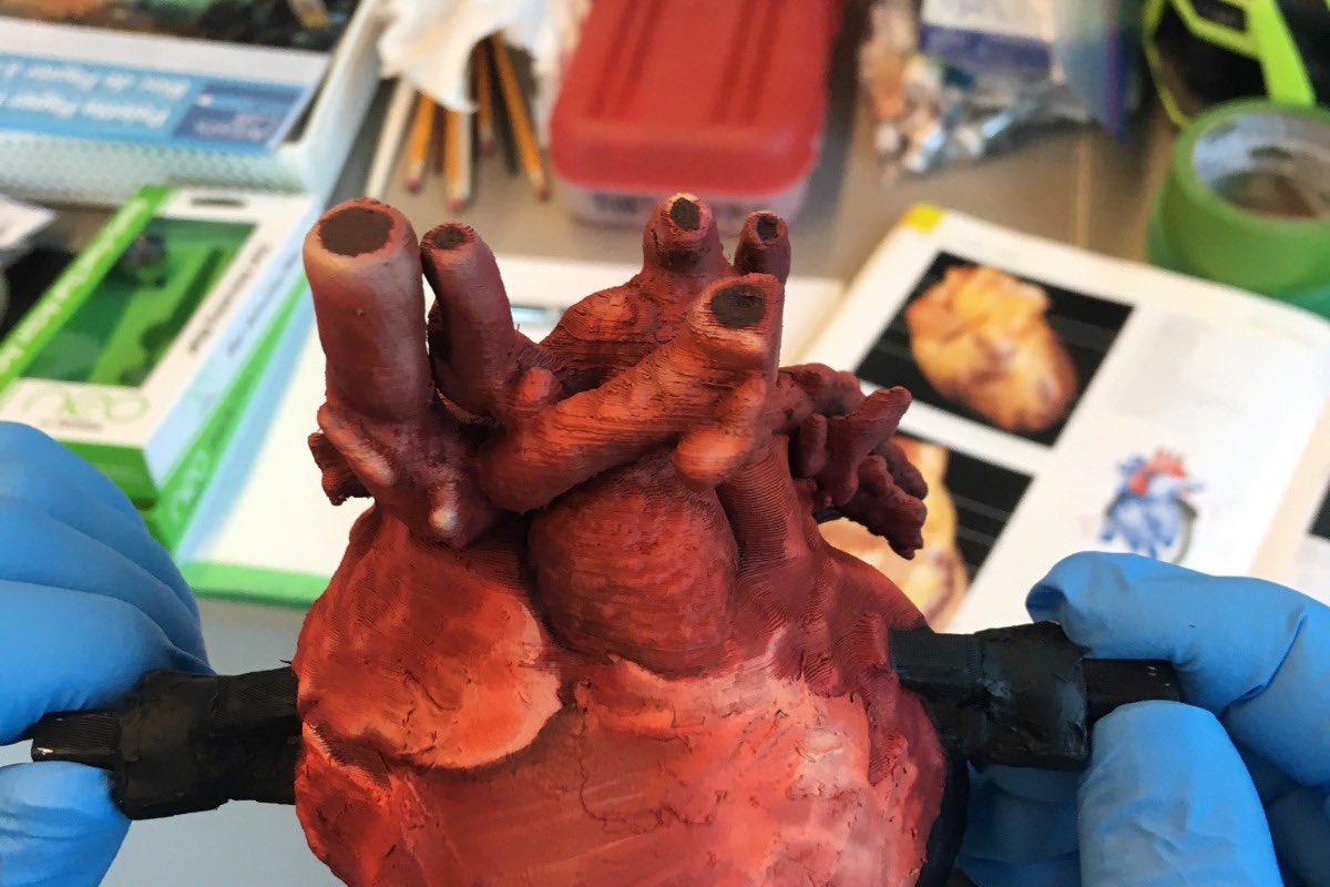 lynsonnenberg's tweet photo. Want to help get us reach our goal of a 3D heart for every patient and for models to be distributed for #MedEd learning across the globe?
https://t.co/UIgo2KlFZS
#3DHeartProject #StarWarsHeart https://t.co/EwPihUoD7t