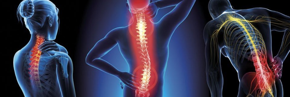DrSusmitNaskar's tweet photo. ➖ #Cervical #SpineSurgery in India
▫️
▫️
➖ Are you suffering from #spinal or any other related pain? Request an appointment with Dr. #SusmitNaskar today. Visit https://t.co/bH9ibCgx1v for appointment.
▫️
▫️
➖ #CervicalSpineSurgery #InvasiveSpineSurgery #SpineSurgery #Sciatica https://t.co/R29CLVmyKu