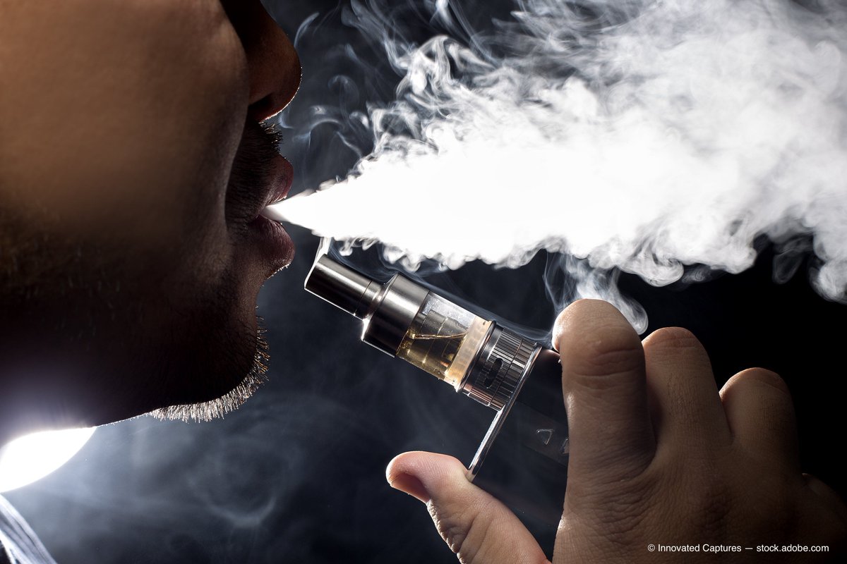 OptometryTimes's tweet photo. How vaping affects the ocular surface. @KathyMastrota #optometry  https://t.co/aRLGJz90xi https://t.co/4hY7QpUzgy