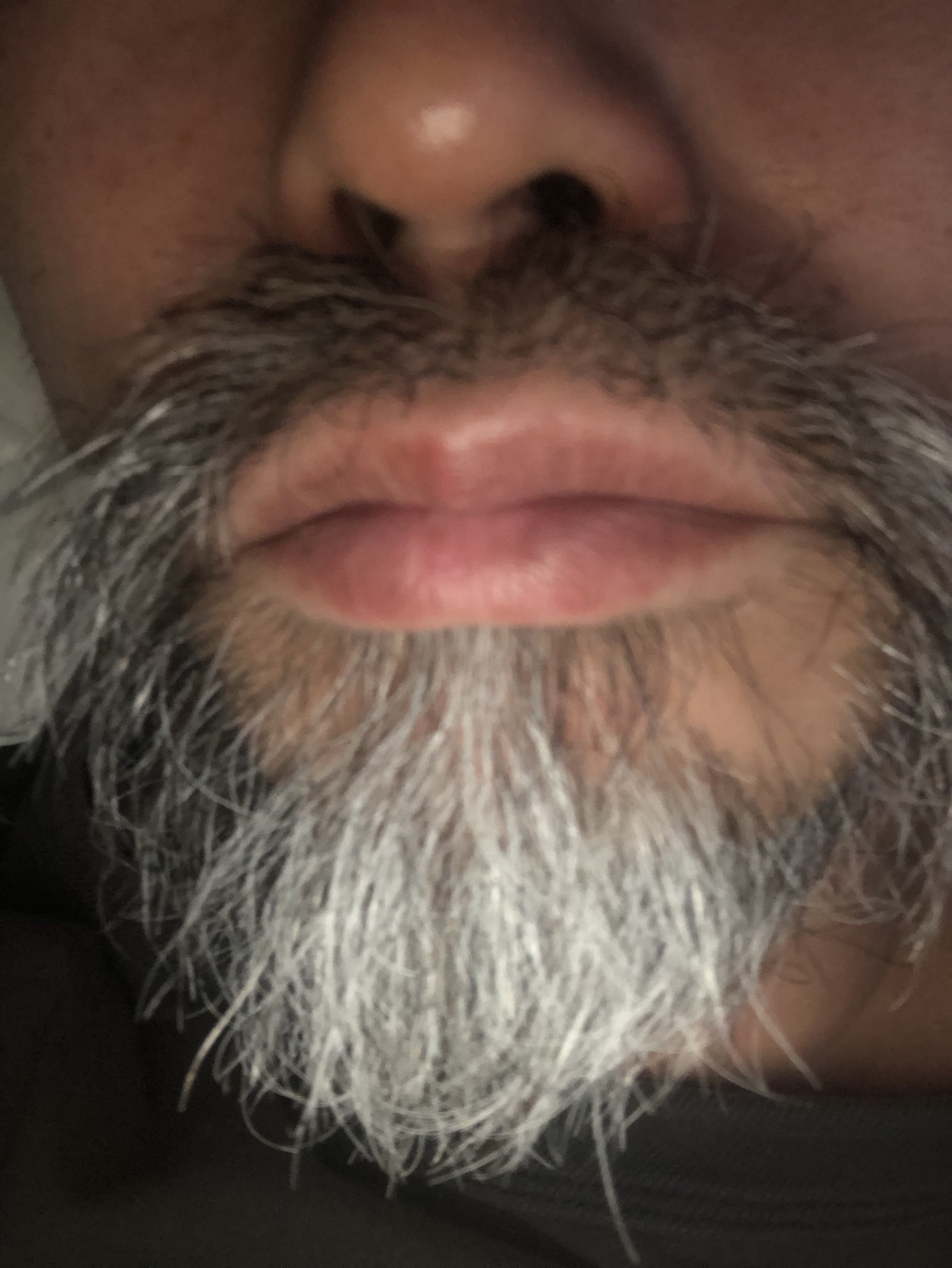 Dr エクアドル ヒゲどこまで伸びるのかなー