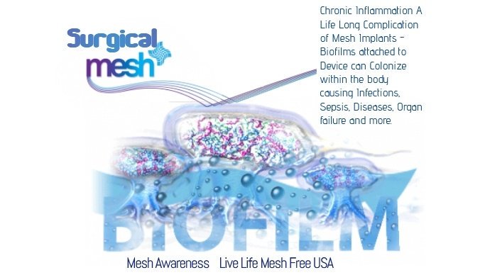 JanUrban12's tweet photo. #worldsepsisday2019 Know the Risks #SurgicalMesh is a Permanent #Implant There is NO #SafeMesh The Complications of a Failed #Mesh #MedicalDevice R #4Life #Help is hard to find #JustSayNo2Mesh #WorldPatientSafetyDay #17September2019 #Biofilms #ChronicInflammation #Sepsis https://t.co/VDCw0frjHk