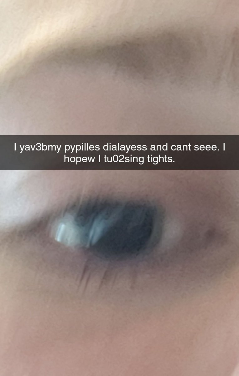 FruitAndAlcohol's tweet photo. Yo twitter so like, I couldnt see at all for like 12 hours and it sucked https://t.co/QOSUlHUew5