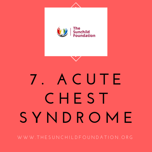 Sunchild_NG's tweet photo. OTHER MANIFESTATIONS OF SCD
No 7. Acute Chest Syndrome:
A lot of doctors are scared of this. https://t.co/T76K5kST9v