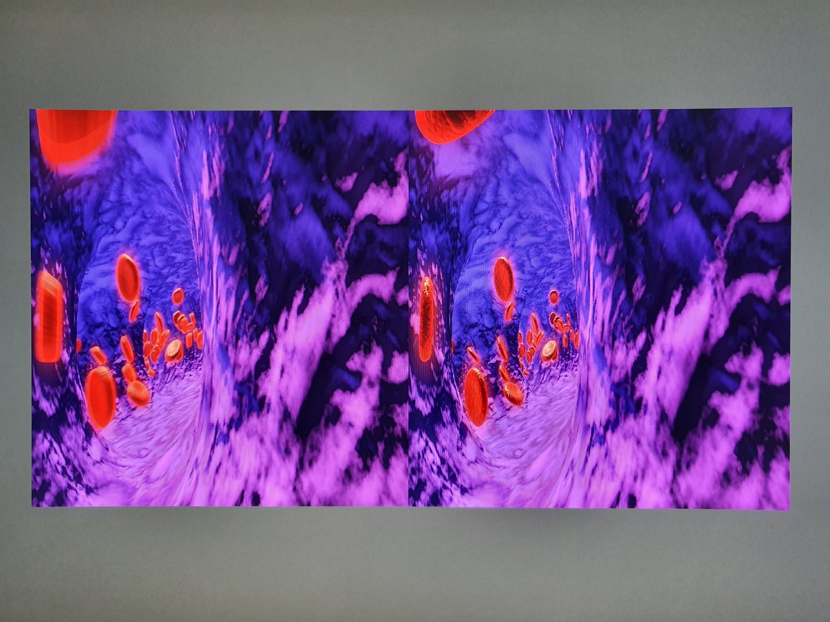 MalocaPeter's tweet photo. Still rendering 6010 frames for #3DAnimation #choriocapillaris #IMAX3DOCT Look at stereoframe nr 3090 from 10.000 thx to dual RTX2080 Titan #Retinopsy 2019 #Lucerne #Switzerland https://t.co/mrphcMeLcb
