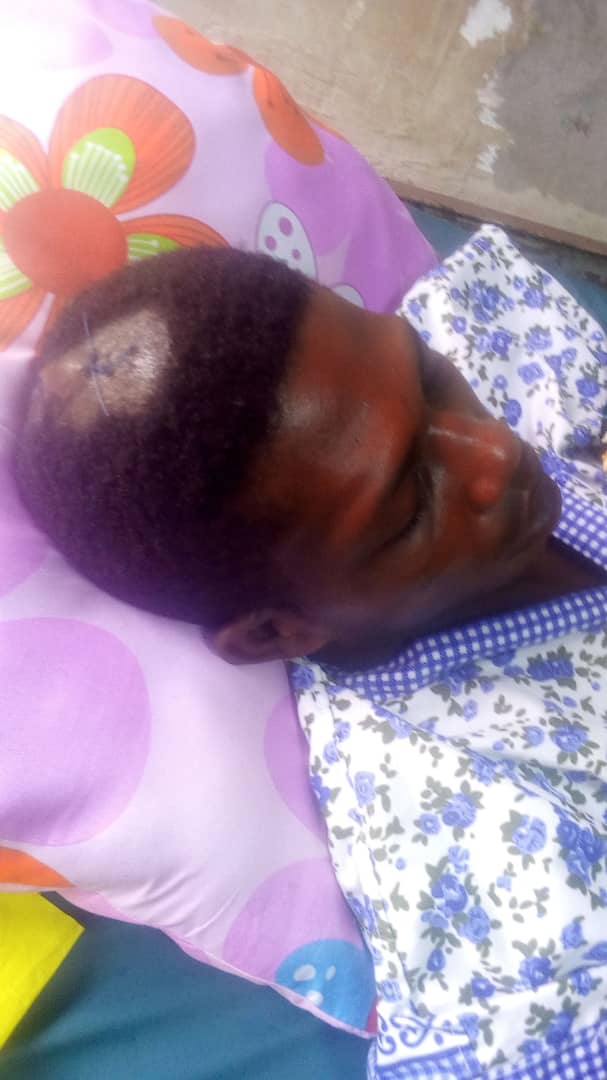 Donokazkar's tweet photo. #JusticeForFUOYE #VOTO
Azeez Elijah AKA ELES (FUOYE 300L LIS Dept), National President Of Library & Information Science Students. He was hit with a tear gas canister on his head during the crisis. @PremiumTimesng @OElij @seunawodola @Ayoung_bee @PoliceNG https://t.co/2JCZ72yaef