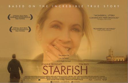 Have you seen Starfish? The heart-breaking story of a man who had to undergo life-saving, but hugely invasive surgeries after contacting #Sepsis #WorldSepsisDay #StopSepsisSaveLives #SepsisAwareness ow.ly/IsQV50w7XXa