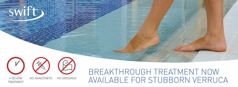 Struggling to treat painful or long standing Verruca? | Swift Microwave Therapy effects result from heat energy. The energy allows precise localised heat production between 41-45°C  ow.ly/lBqD30pvzwq