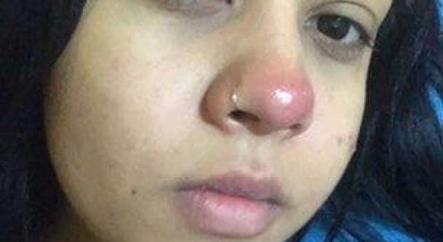leParrainRDC's tweet photo. "Un piercing au nez l'a rendu paraplégique" À l'âge de 20 ans, #Layane Dias était une étudiante en ressources humaines qui était dans l'attente de son premier stage. Elle avait également hâte de partir en voyage en famille dans un mois. https://t.co/HTgVuMAplW