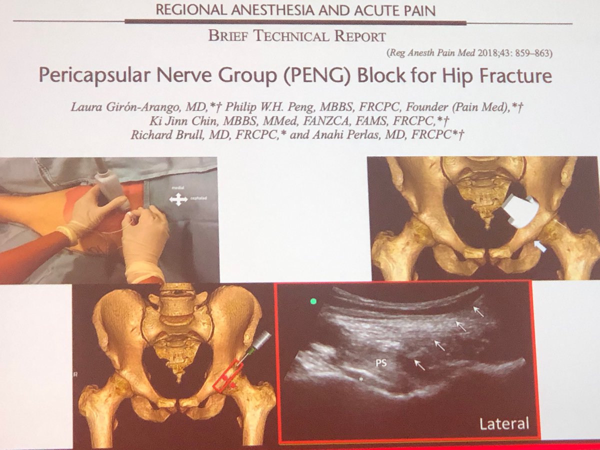 Who else at #ESRA2019 has a block named after themselves