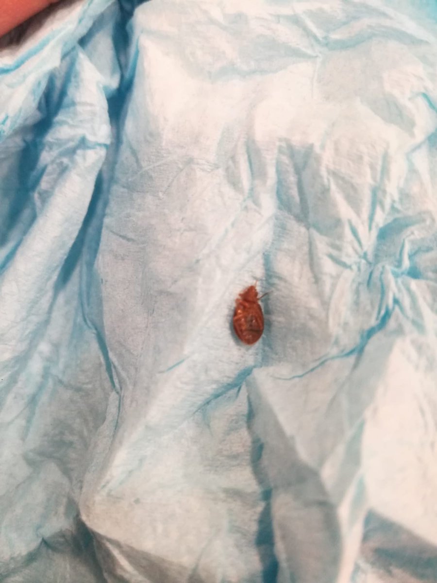 viaggichemangi's tweet photo. Un #viaggio da incubo su @Minoan_Lines del gruppo @GrimaldiLines.
Questo è il mio stato attuale dopo essere stata mangiata viva dalle cimici da letto!
Condividete se potete: che i nuovi passeggeri sappiano a cosa vanno incontro!!!
Condizioni igienico sanitarie vergognose!!! https://t.co/CX365WMLaU