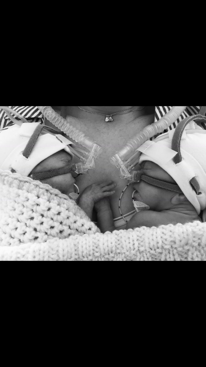 goodallvic's tweet photo. #NICUawarenessmonth #nicu107days #27weekertwins #teamgoodall
As ever we are so grateful to the amazing neonatal team @PRM_NEO_Team fondly known in our house as the Aunties & uncles who took the best care of our twins for 4 months ๐๐ https://t.co/bVKjl5WayD