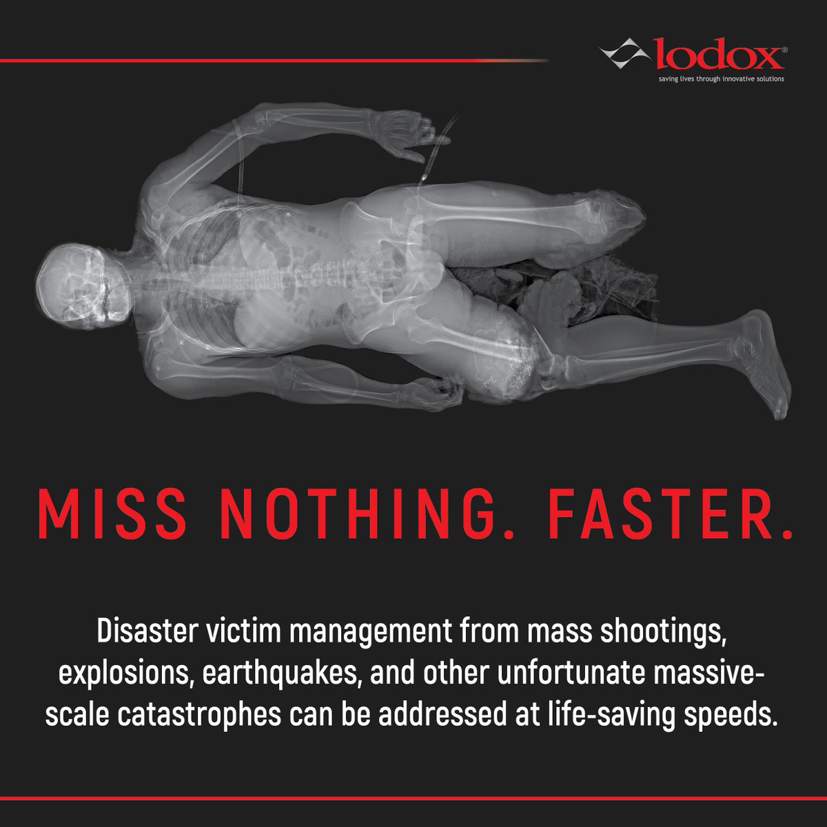 LodoxSystems's tweet photo. Lodox’s key advantage in #emergencyimaging is the ability to provide a rapid, overall picture of the extent and severity of injuries, without ever losing sight of the patient. #ASER2019 | @ASER_ERad https://t.co/1QcGWQFDBg