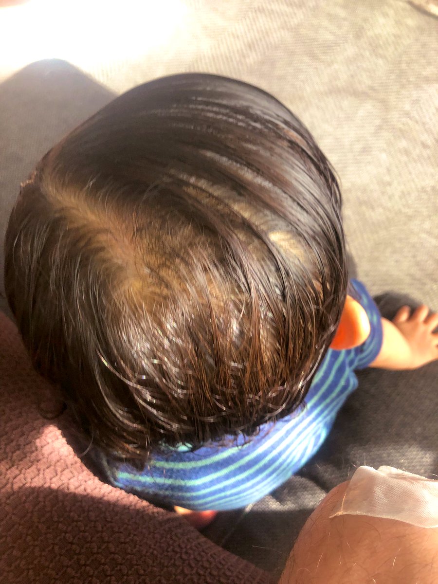 萬福食堂 Sur Twitter ガムテープを父のももに貼って一気に剥がし毛をむしる作業に夢中の娘の髪の毛を定年間近の係長風に仕上げたお風呂上がり