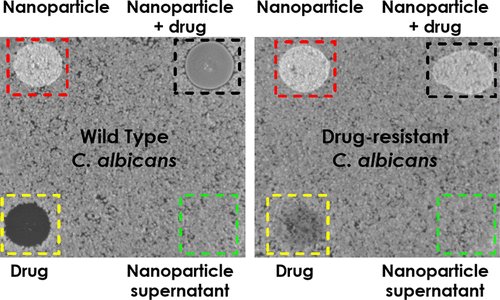 nanotrac's tweet photo. ACS AMI [ASAP] Characterization of Key Bio–Nano Interactions between… https://t.co/1f4VzT0MRh Via @ACS_AMI #ACSAppliedMaterialsAndInterfaces #InterdisciplinaryCommunity #ScienceJournal #CoatingMaterials #BiologicalApplications #EnergyApplications #FunctionalInorganicMaterials https://t.co/3mC0apU4Fn