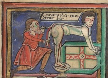 Some butts need a hand(these are medical procedures, so LOOK AWAY if you're squeamish)(BL, MS Harley 1585 f. 9; BL, MS Sloane 3844 f. 15v; BL, MS Sloane 1975 f. 93) #MedievalTwitter