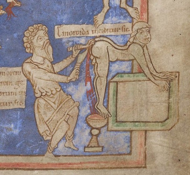 Some butts need a hand(these are medical procedures, so LOOK AWAY if you're squeamish)(BL, MS Harley 1585 f. 9; BL, MS Sloane 3844 f. 15v; BL, MS Sloane 1975 f. 93) #MedievalTwitter