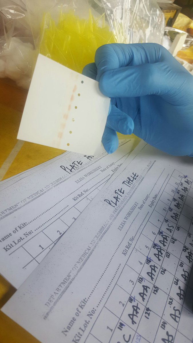 simofsicklecell's tweet photo. This is the cellulose acetate paper being used in the HB electrophoresis. https://t.co/ncStvdOVmi