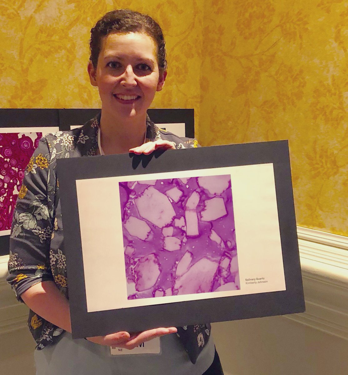 K_JohnsonMD's tweet photo. Pleasantly surprised to see my artwork selected as a finalist at #cap19orl for their #microbeauty photo contest 😱😁☺️ @mcwpathology @Pathologists #salivaryquartz Vote for your favorite and help raise money for the @CAPFndn at the silent auction! https://t.co/ZJn0VLArV4