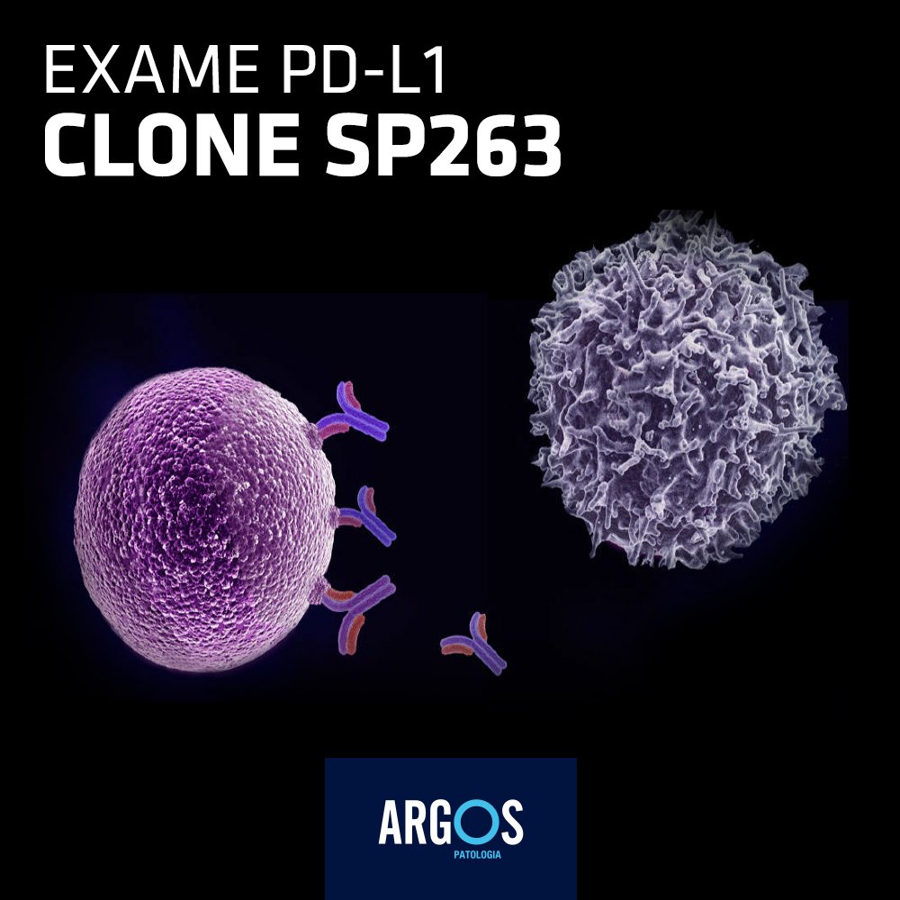 í¸ìí°ì Imunoterapia í´ìíê·¸