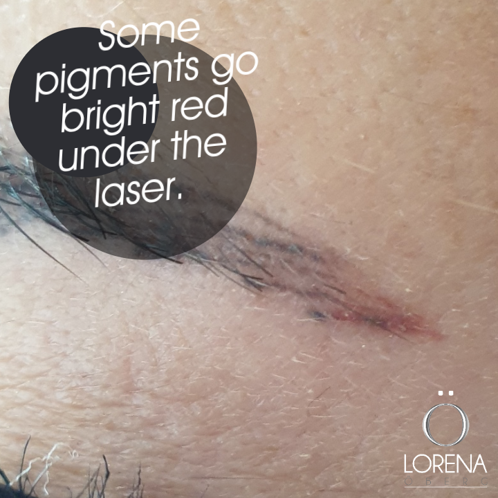 Watch the full explanation on our YouTube channel s.ripl.com/qoka3m
#permanentmakeup #micropigmentation #microblading #pmu #pmu #pmuremoval #tattooremoval