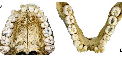 theAFOHR's tweet photo. #AFOHR #ForensicOdontology Sustainable goals #FOSGs.
GOAL 2
#HumanIdentificationAction = Take actions to improve human #Identification, performing a complete #dentalautopsy, on-site or remotely. Combat disparity in human ID postmortem process
#humanitarianforensicodontology https://t.co/6nYUPnwMab