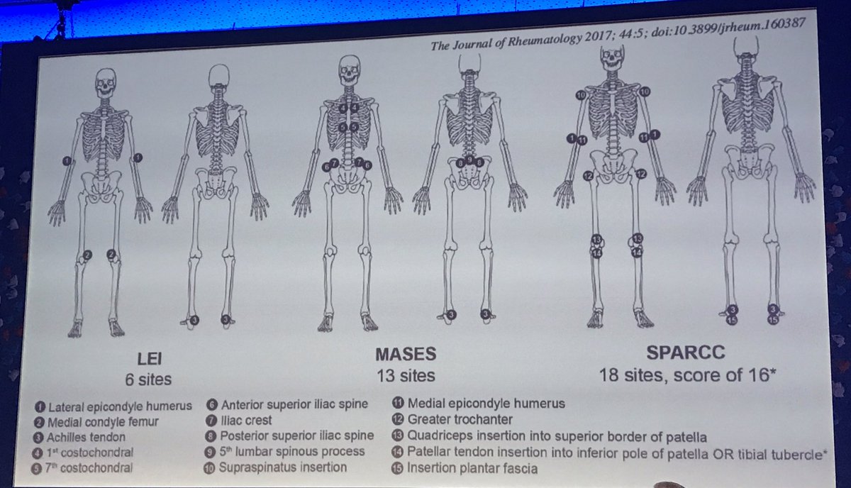 JL_tdp's tweet photo. Una charla muy interesante entesitis & artropatia psoriasica Dr. Julio Ramírez #entesitis #psoriasis #arthritis #IMIDS https://t.co/62zpNuwvKb