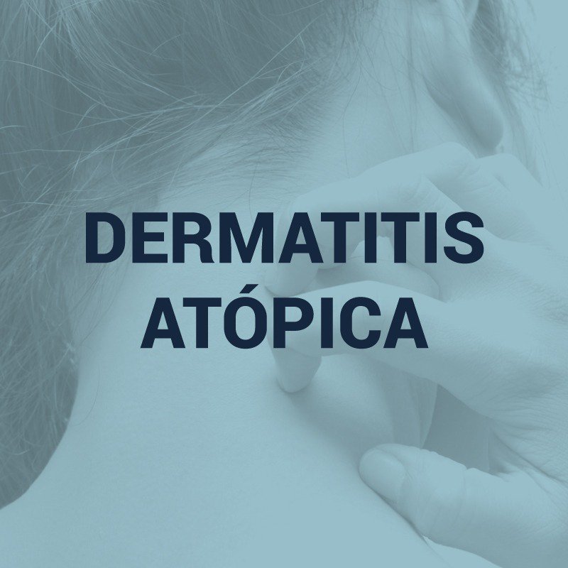 ADAR_oficial's tweet photo. Día Mundial de la #DermatitisAtopica 
Ayudanos a compartir el mensaje. #DíaMundialDermatitisAtopica                                                              #AtopicEczemaDay #ADAR 9 #WDAD19 https://t.co/BONhm4HEIy