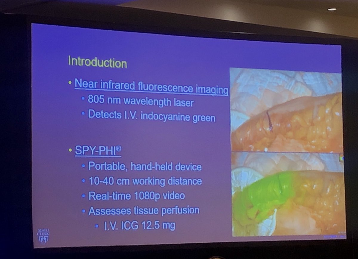candacegranberg's tweet photo. Near-infrared #fluorescence not only looks cool, gives real-time assessment of tissue perfusion during ureteral #stricture repair. Reminds me of Slimer from @Ghostbusters... @KevinHebertMD @boyd_viersMD @MayoUrology @MayoClinic @NCSAUA #SPYPHI https://t.co/kEROh110xY