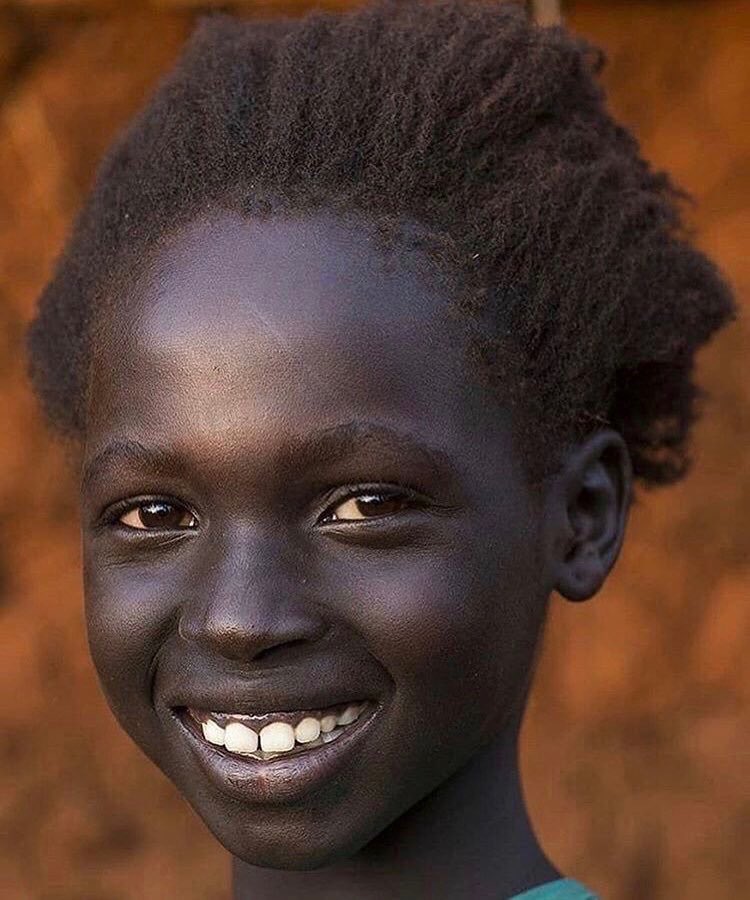 BereteM09268314's tweet image. #Laguineedenosjours c&apos;est rare de trouver une fille de teint naturel grâce à la #dépigmentation