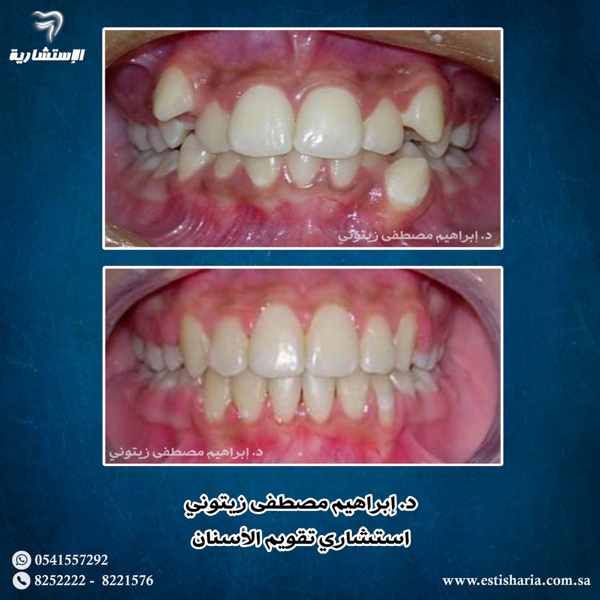 estisharia1's tweet photo. الدكتور إبراهيم مصطفى زيتوني (استشاري تقويم الأسنان)
#الاستشارية_لطب_الأسنان
#المدينةالمنورة- سلطانه - ابراج غوث - البرج الأول - الدور السابع
0541557292 -8252222 https://t.co/mUqFKwwUab