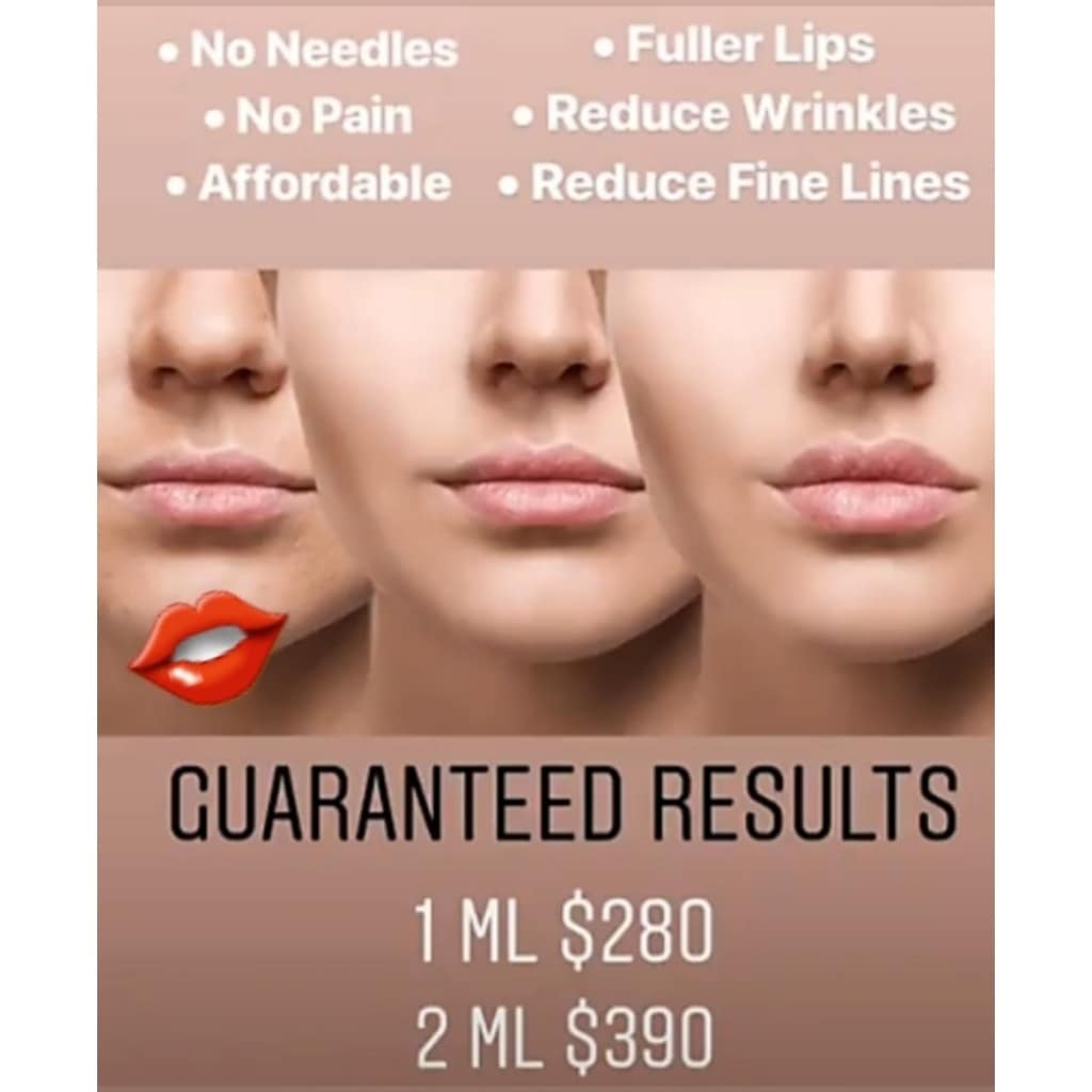 BellaMonetVegas's tweet photo. #bellamonetaesthetics #hyaluronicacid #supertags #instapic #hyaluronpen #vegas #skin #aesthetics #instapic #instastyle #instamood #whatwrinkles #Hyaluronpenlips #hyaluronenhancements #Hyalurondefinechin #Hyaluronplump #Hyaluron #hydrated #beauty #filler #acids #HA #estheticians https://t.co/Gmp3ohLpzH