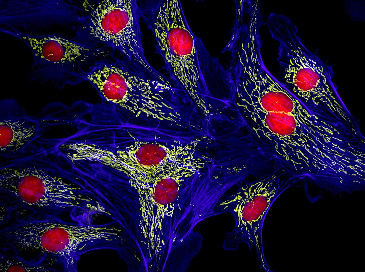 MAG2ART's tweet photo. Cells from a cow.
#CellBiology #microscopy https://t.co/Vy3KTf8ptk