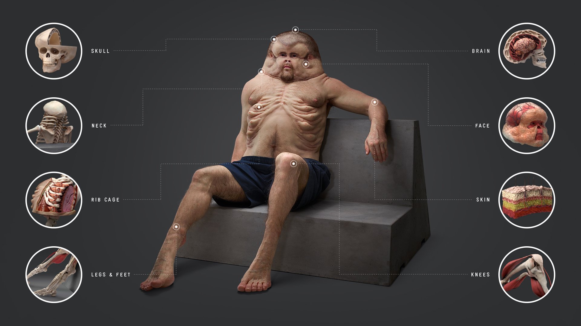 Twitter 上的 Inspi 交通事故に遭っても死なない唯一の人間 Graham グラハム 豪ビクトリア州の政府組織tacの啓蒙施策 16 Grahamには首が無く 脳を守るために頭蓋骨が肥大化 皮膚は厚く頑丈で 膝の関節はあらゆる方向に折り曲がる Tacはgrahamの設計