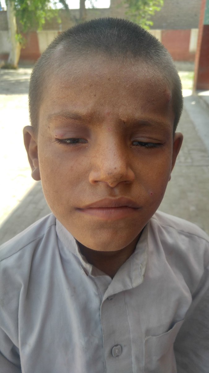 ZafarSh13182628's tweet photo. Health Education Session on dengue awareness in school and caring of sick students and ensuring treatment of these students. https://t.co/bnAaNRFe3O