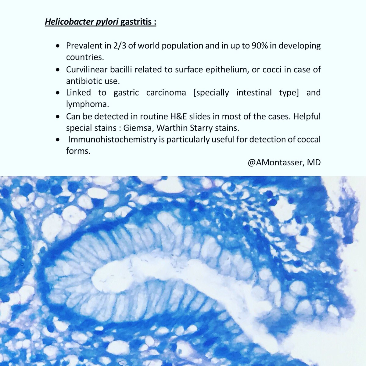 AMontasserMD's tweet photo. #Pathology #Pathboards #PathologyisNice #GIpath https://t.co/saE0k37Q2D
