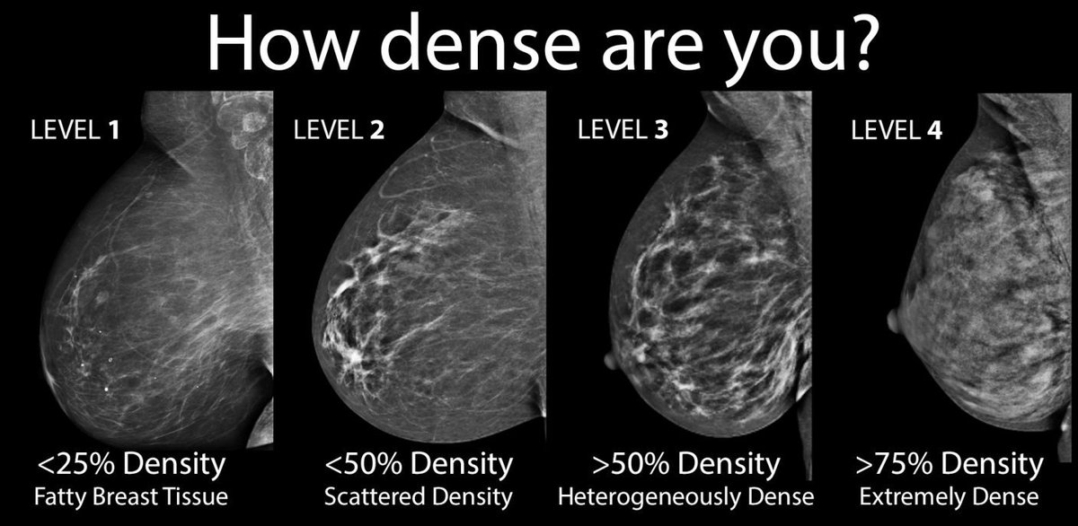 BreastDensity masks Breast Cancer
It's determined by a Mammogram 
It's not palpable, you can't feel it
40% of women have #Densebreasts
Women in Ireland are NOT routinely told about it
Can you tell us why <a href="/paulreiddublin/">Paul Reid</a>
<a href="/HSELive/">HSE Ireland</a> <a href="/IrishCancerSoc/">Irish Cancer Society</a>
#TellWomen