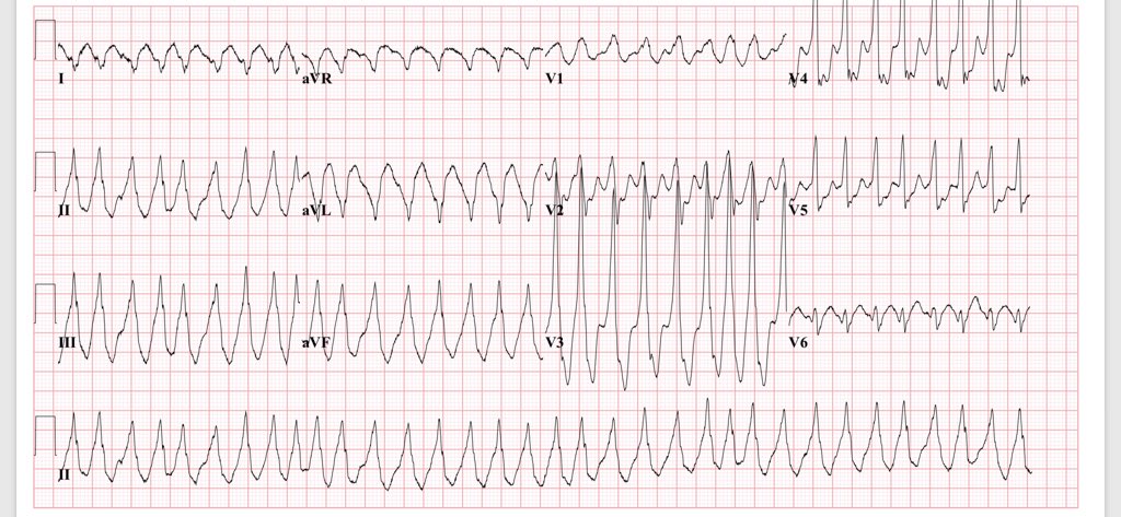Mounir Basalus (Ⲃⲁⲥⲓⲗⲓⲟⲥ) tweet media