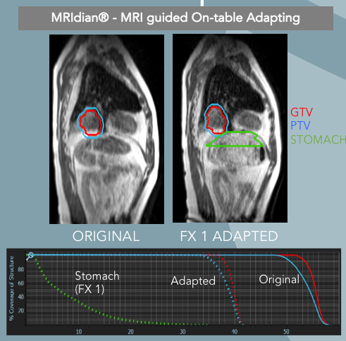 viewray's tweet photo. Join us at 10:30am in the booth to hear Prof. Hiroshi Igaki, MD of the National Cancer Center Hospital in Japan talk about unlocking the clinical potential of MR-guided #onTableAdaptive radiotherapy. He’s making it happen for cancer patients in Japan. #ASTRO19 https://t.co/fb9OUmHDs4