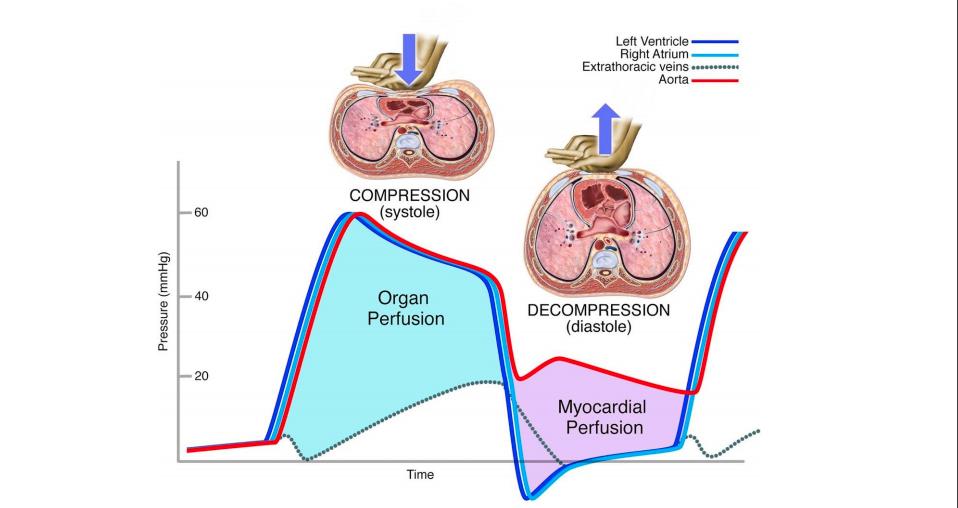 metc_ec's tweet image. Prevención de lesión por reperfusion durante el paro cardíaco, RCP de alta calidad
#CPR #CPRHighPerfomance #ASHILATAM @AshiMedic @ECSInstitute #ASHICPR #ASHI #ECSI buff.ly/32JcAbw