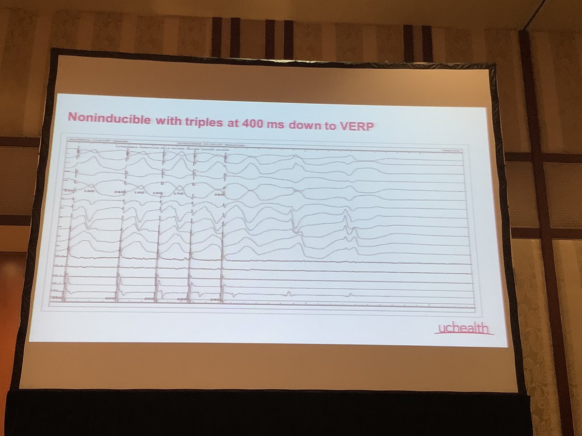 DebbeMcCall's tweet image. #COArrhythmia2019 Case Presentations from the Front Lines: Techniques and Endpoints for #Ablation of Ventricular Tachycardia #VTach - Ethan Ellis [EE] @uchealth