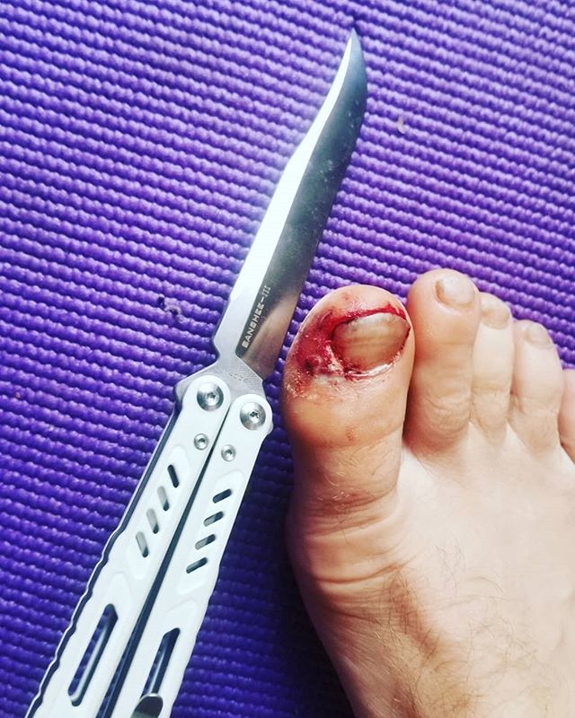 KowalskiDylan's tweet photo. Should have wore shoes when flipping my knife. #maxace #balisong #butterflyknife #ouch https://t.co/SDnNKZ4DlS