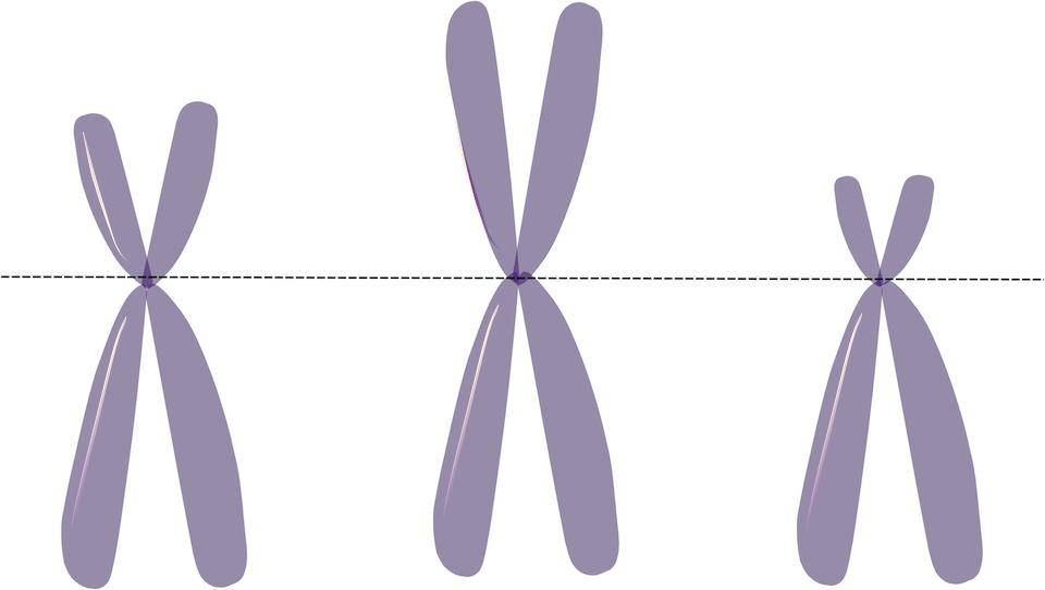 Omicsjournals's tweet photo. Ring #Chromosome and Clinical Findings https://t.co/hopLvRBozS https://t.co/LbdH6ZXFQN