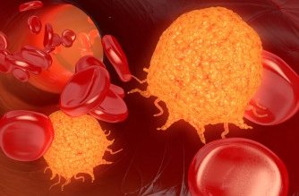 #LipoproteinLipase in #ChronicLymphocyticLeukaemia – Strong #biomarker with lack of functional significance read full article on bit.ly/2lW2IuY