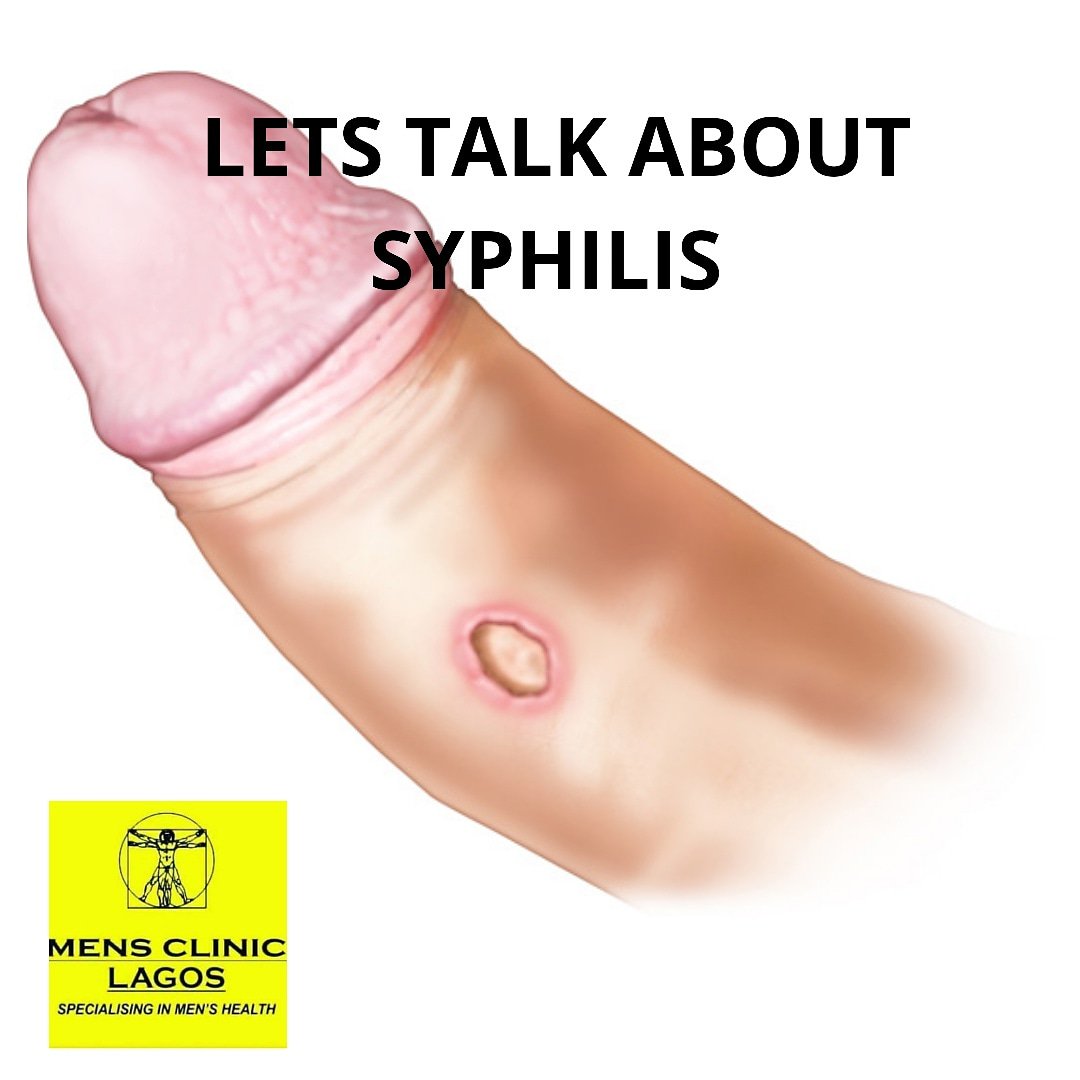 Pdf A Systematic Review Of Syphilis Serological Treatment Outcomes In Hiv