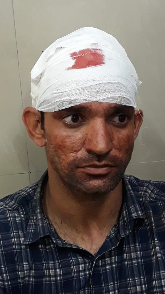 #cmoharyana #bjpharyana #PMO हक मांगते कंप्यूटर टीचर्स पर बर्बरता पूर्ण किया गया लाठीचार्ज यह है हरियाणा का दृश्य है क्या यह है वह अच्छे दिन कंप्यूटर टीचर