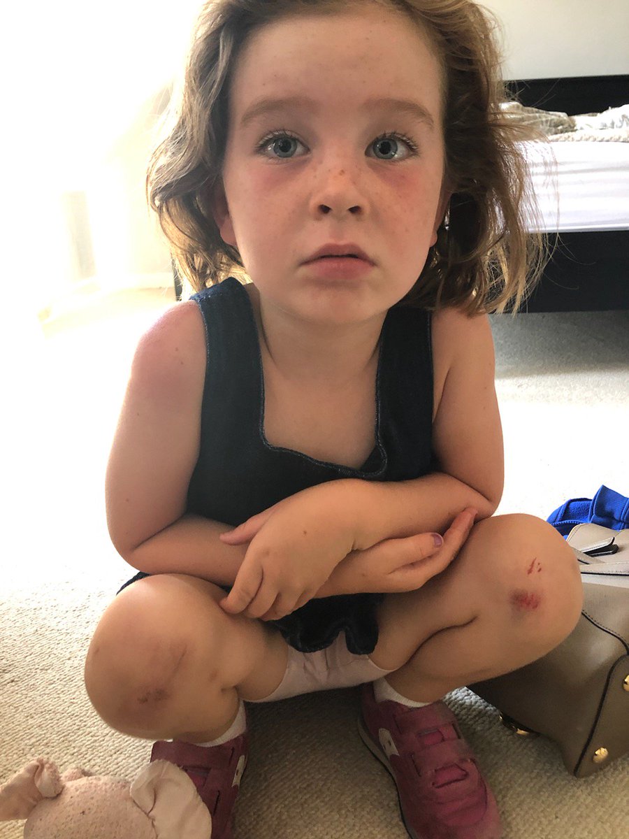juneshere's tweet photo. "Beau wanted to race me but then he was going really fast and so then I was running really fast because I wanted to win, and then I fell." https://t.co/NiVGRsmMMm