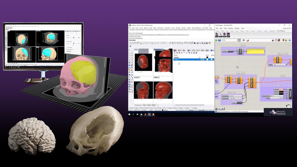 The new release of Rhino3DMedical is now available, including Grasshopper components to read, analyse and process 3D medical images!

FREE (45 days) LICENSE KEY: rhino3dmedical.mirrakoi.com